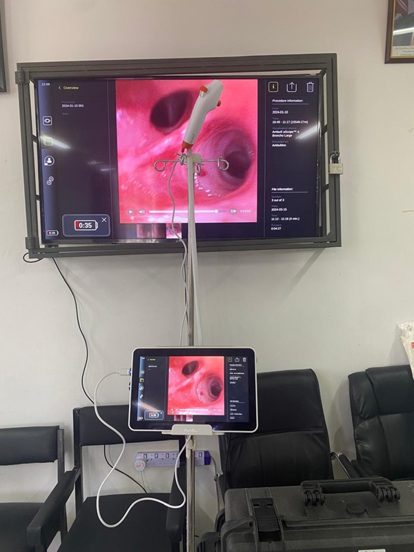 Bronchoscopy